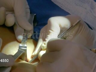 Aj υπήνεμος από wwe παίρνει αυτήν third στήθος implant: ελεύθερα βρόμικο βίντεο 8e
